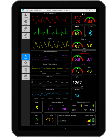 Hemodynamic monitoring tablet inferface