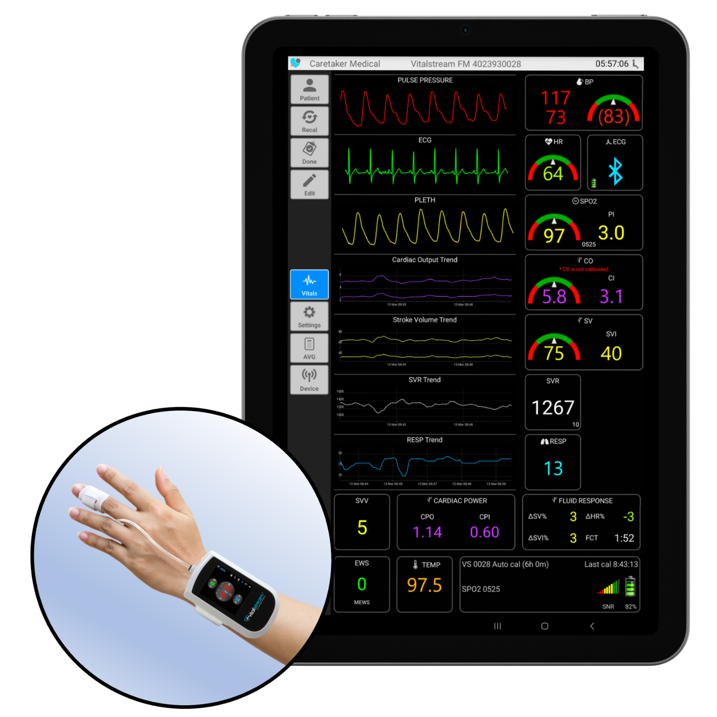 VitalStream tablet and wearable vital signs monitor