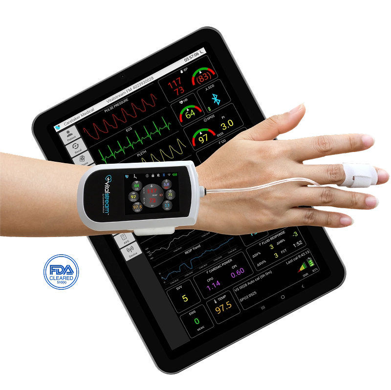 Vitalstream Wearable on wrist