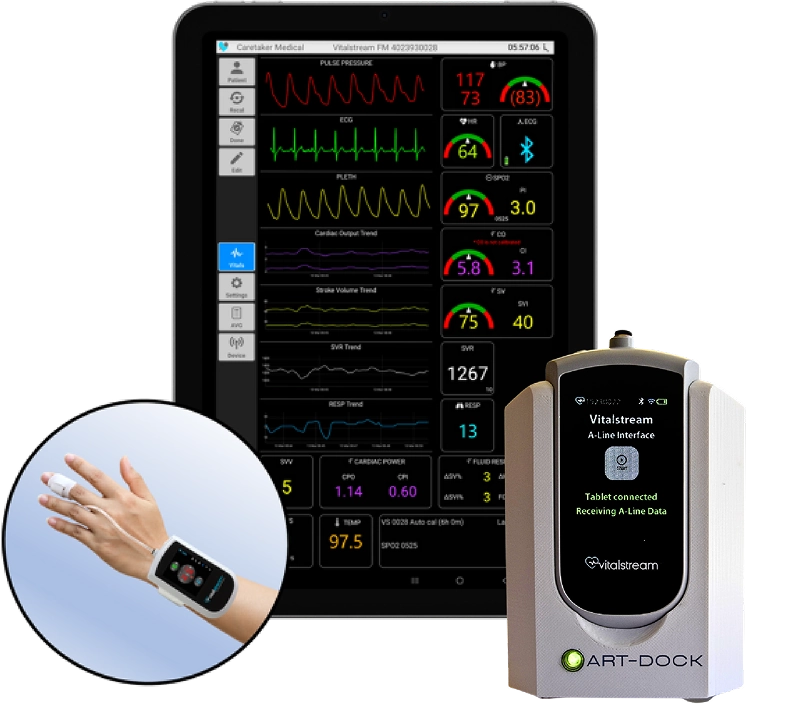 VitalStream Wearable with dock